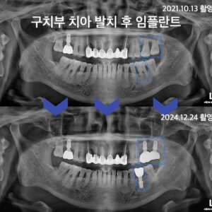 북변동치과추천7